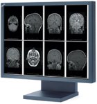 NEC MultiSync 2MP 21" LCD Medical Display (Clear Base)