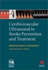 Cerebrovascular Ultrasound in Stroke Prevention and Treatment