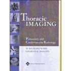 Thoracic Imaging: Pulmonary and Cardiovascular Radiology