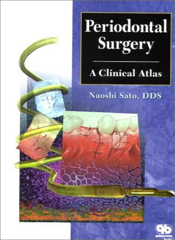 Periodontal Surgery: A Clinical Atlas