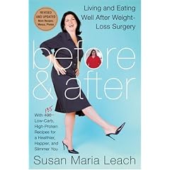 Before & After, Revised Edition: Living and Eating Well After Weight-Loss Surgery