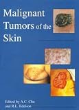 Malignant Tumors of the Skin (A Hodder Arnold Publication)