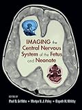 Imaging the Central Nervous System of the Fetus and Neonate