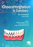 Osseointegration in Dentistry: An Overview