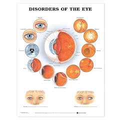 Disorders of the Eye Chart