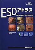 ESD�A�g���X�\���u��̑I���ƕ��ʕʍU���@