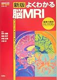 新版 よくわかる脳MRI