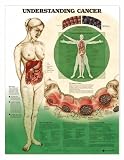 Understanding Cancer Anatomical Chart Plastic Styrene
