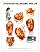 Conditions For Cesarean Section Anatomical Chart Laminated
