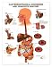 Gastroesophageal Disorders Anatomical Chart Unmounted
