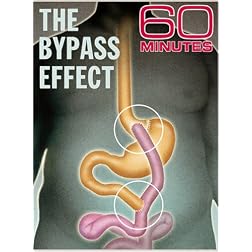 60 Minutes - The Bypass Effect (April 20, 2008)