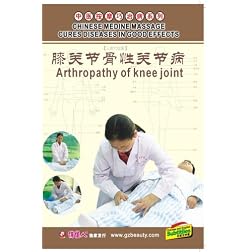 Osteoarthrosis of Knee Joint