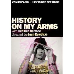 History on My Arms