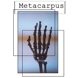 Metacarpus (Institutional Use - Library/High School)