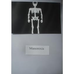 Manorexia