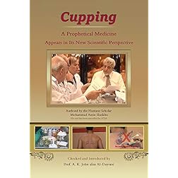 "CUPPING" a prophetical medicine appears in its new scientific perspective