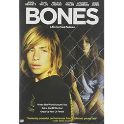 Bones
