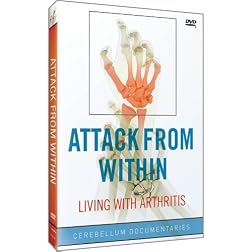Attack from Within: Living with Arthritis